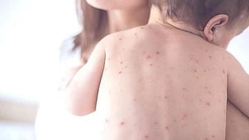 Βρες ποιοι είναι οι εξειδικευμένοι παιδοδερματολόγοι σε όλη την Κρήτη, από Ηράκλειο, Χανιά, Ρέθυμνο μέχρι και Άγιο Νικόλαο